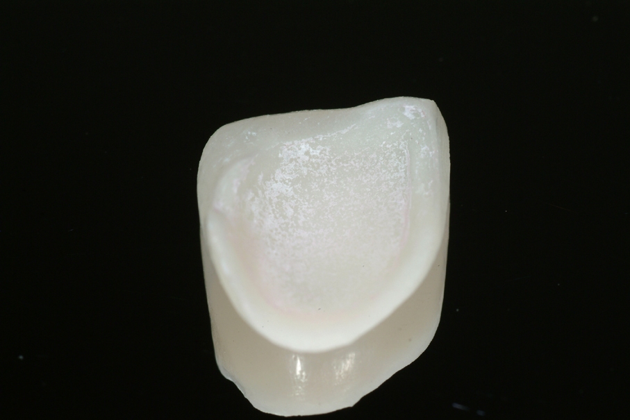 denti-trottolino-037-1